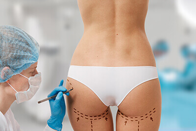 Antalya-Gluteoplasty